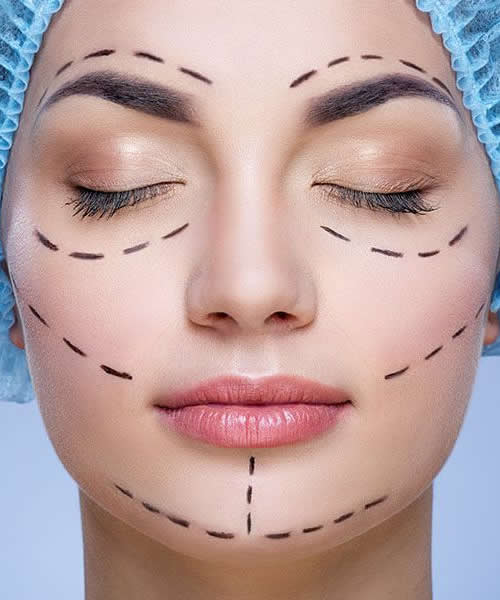 Lifting Facial sin cirug&iacute;a: Dr. Byron Vaca